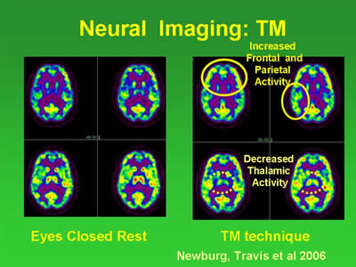 Neural Imaging of the brain